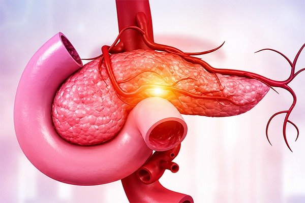 What Are the Risks or Complications of Pancreatic Cancer Surgery?